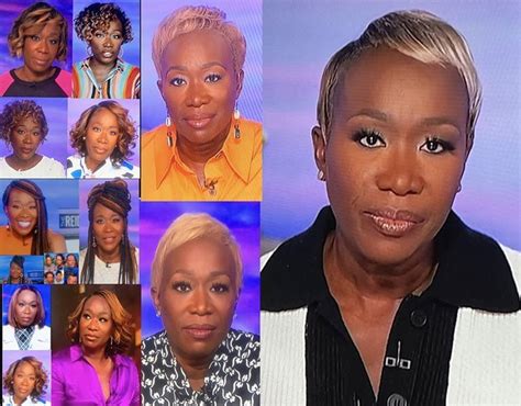 does joy reid have alopecia.